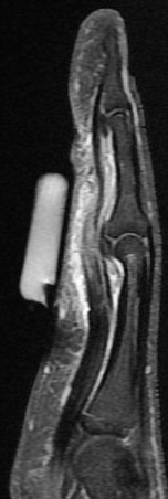 Figure 4 for case gout arthritis ( RID3567 )
